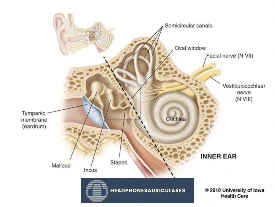 El oído interno (de uihc.org/health-topics/stapedectomy)